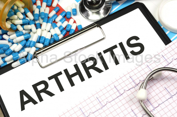 arthritis