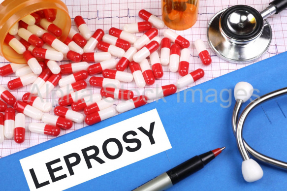 leprosy