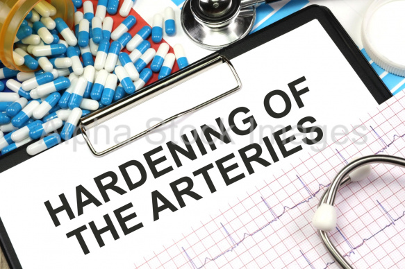 hardening of the arteries