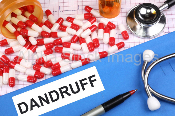 dandruff