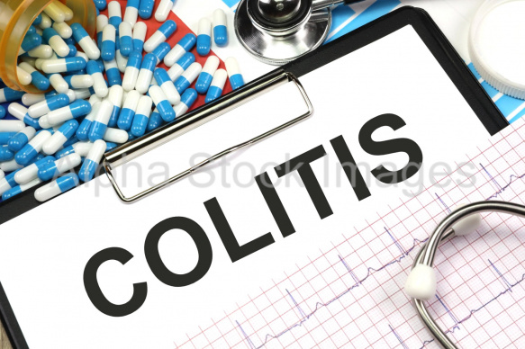 colitis