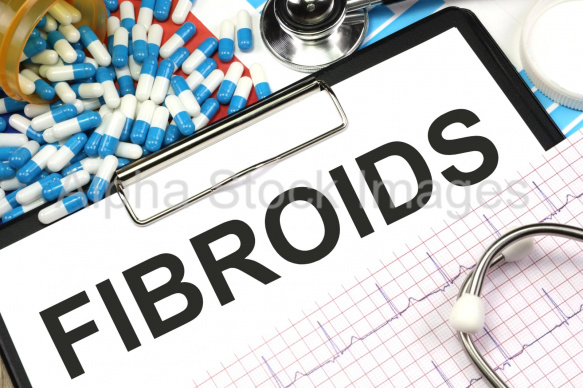 fibroids