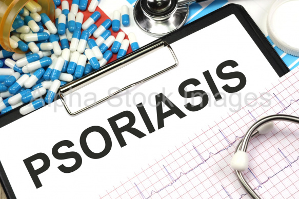 psoriasis