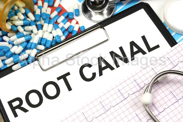 root canal