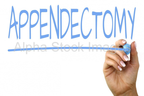appendectomy