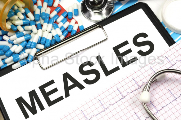 measles