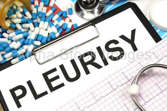 pleurisy