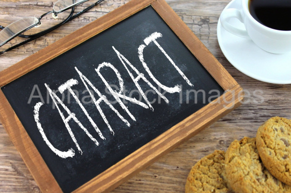 cataract