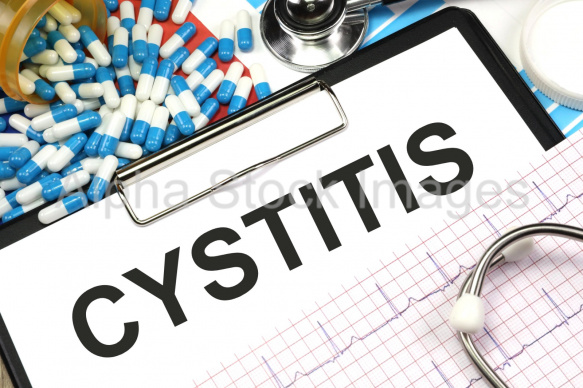 cystitis