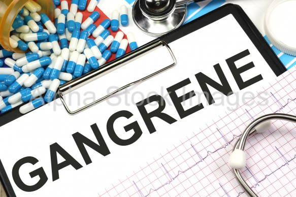 gangrene