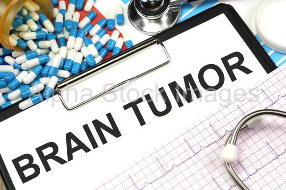 brain tumor