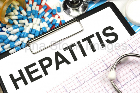 hepatitis