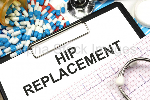 hip replacement