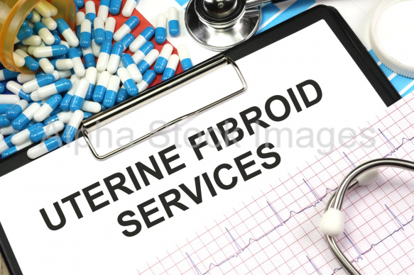 uterine fibroid services