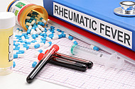 rheumatic fever