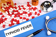 typhoid fever