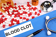 blood clot