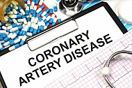 coronary artery disease