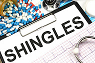shingles