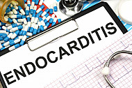 endocarditis