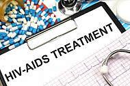 hiv aids treatment