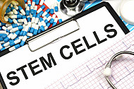 stem cells