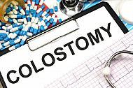 colostomy