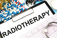 radiotherapy
