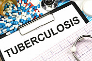 tuberculosis