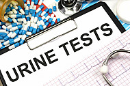 urine tests