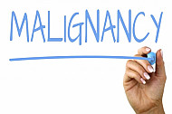 malignancy