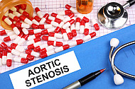 aortic stenosis