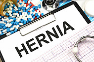 hernia
