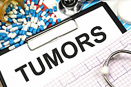 tumors