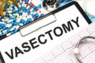 vasectomy