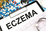 eczema