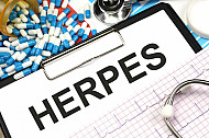 herpes