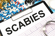 scabies