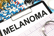 melanoma