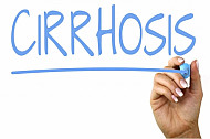 cirrhosis