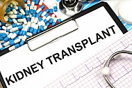 kidney transplant