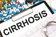 cirrhosis