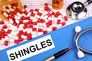 shingles