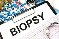 biopsy