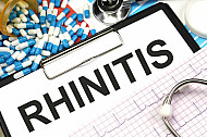 rhinitis
