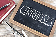 cirrhosis