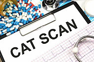 cat scan