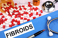 fibroids