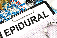 epidural