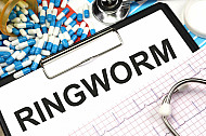 ringworm